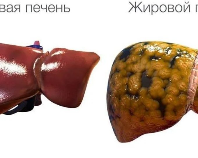 Как заставить печень 