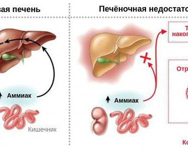 Печеночная недостаточность