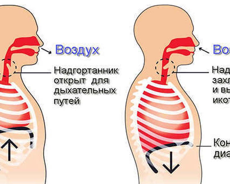 Как избавиться от икоты
